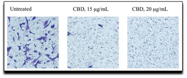 Efeito antineoplásico do CBD em células de neuroblastoma humanas (SK-N-SH)  após 24 horas da administração [PubMed] http://www.ncbi.nlm.nih.gov/pmc/articles/PMC4791143/pdf/conc-23-s15.pdf 